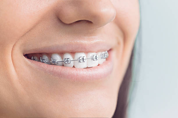 Best Dental Fillings (Composite and Amalgam)  in Woodmere, NY